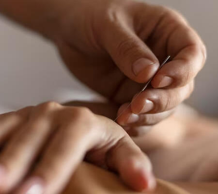 Guide til akupunktur uddannelse